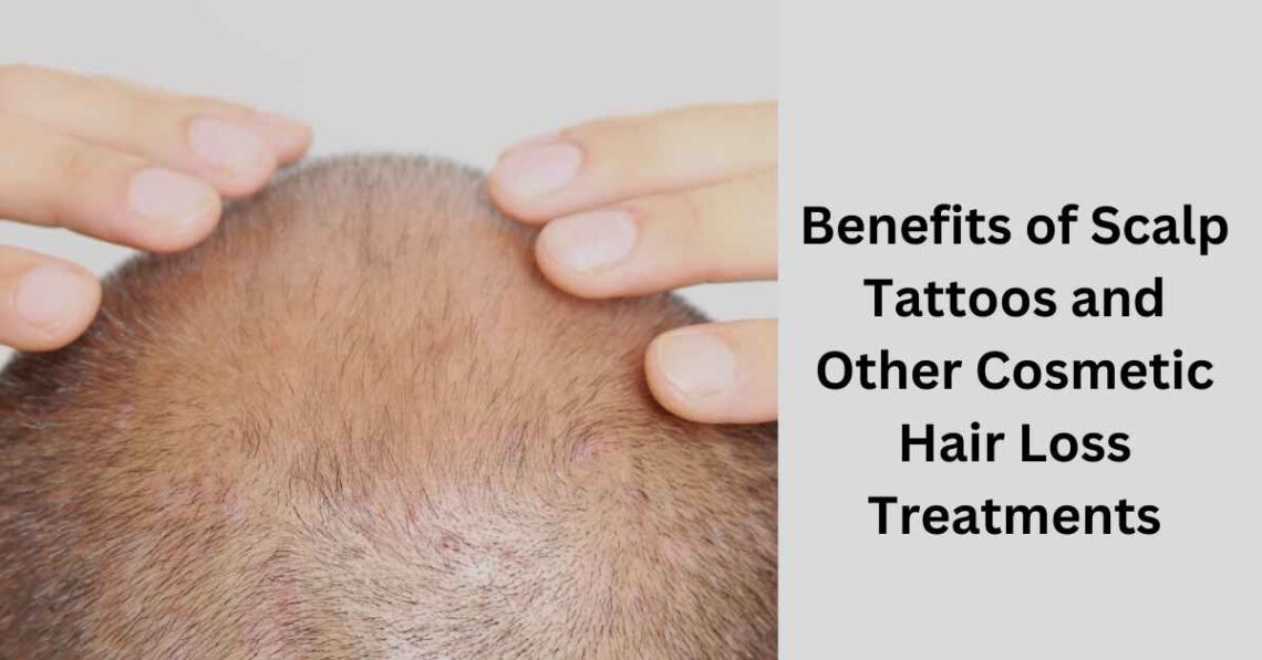 Benefits of Scalp Tattoos and Other Cosmetic Hair Loss Treatments